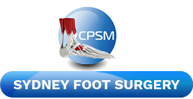Sydney Foot Surgery - Dr. Haydar Ozcan