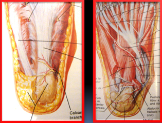 Arch Pain