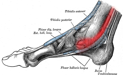 Tendon/Ligament Pain